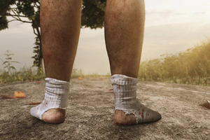 Chaussette sale et trouée, portée par des jambes poilues.